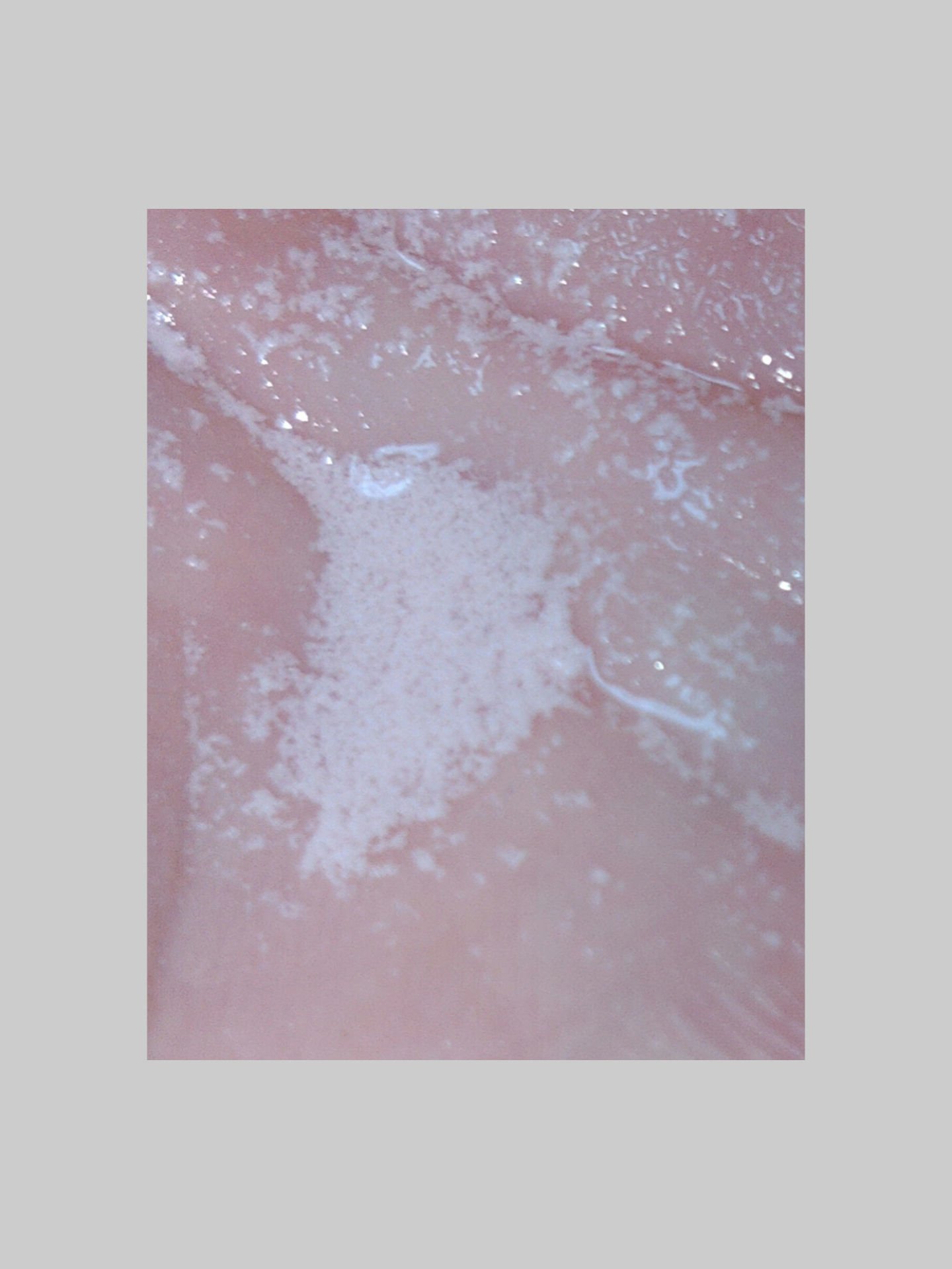 ジンクテカBセラムセット/BRING GREEN/スキンケアキットを使ったクチコミ（2枚目）