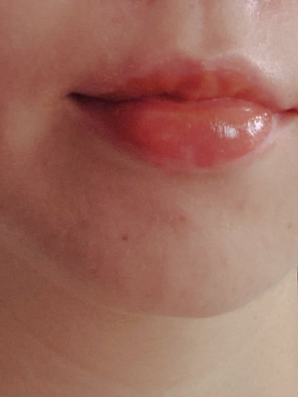 フルーティーグラムティント/Laka/リップティントを使ったクチコミ（3枚目）