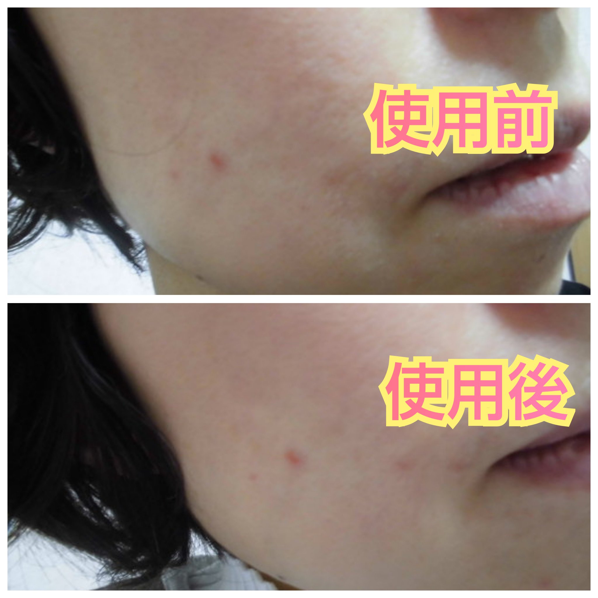 アレンシアフレッシュもちソープ「ロイヤルローズヒップ」/アレンシア/その他洗顔料を使ったクチコミ（2枚目）