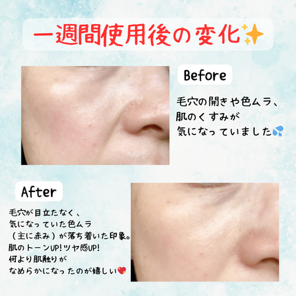 PDRN+ デイリーマスク/VT/シートマスク・パックを使ったクチコミ(5枚目)