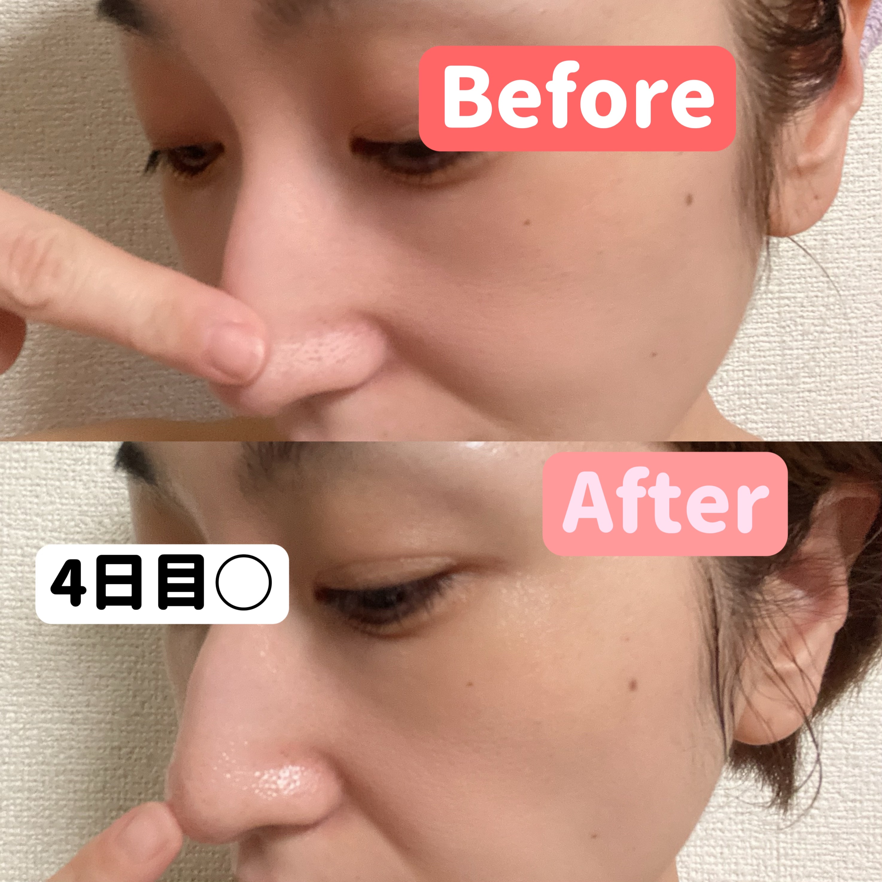 アレンシアフレッシュもちソープ「ロイヤルローズヒップ」/アレンシア/その他洗顔料を使ったクチコミ（3枚目）