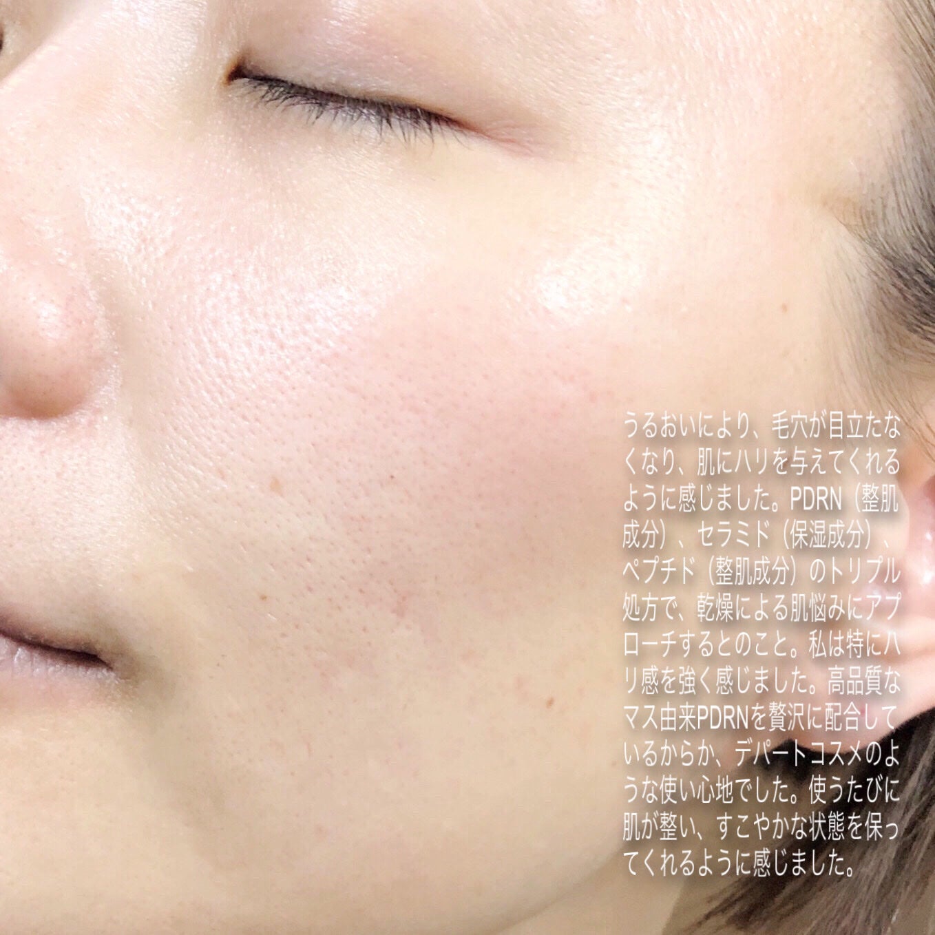 NDSポイントショット2000アンプル/ISOI/美容液を使ったクチコミ(4枚目)