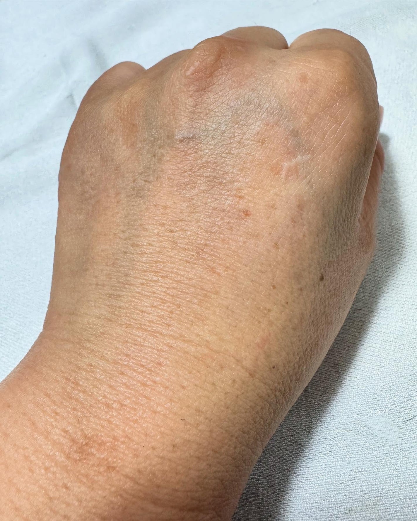 プレミアムもちソープ「グリーンアルティザン」/アレンシア/その他洗顔料を使ったクチコミ(8枚目)