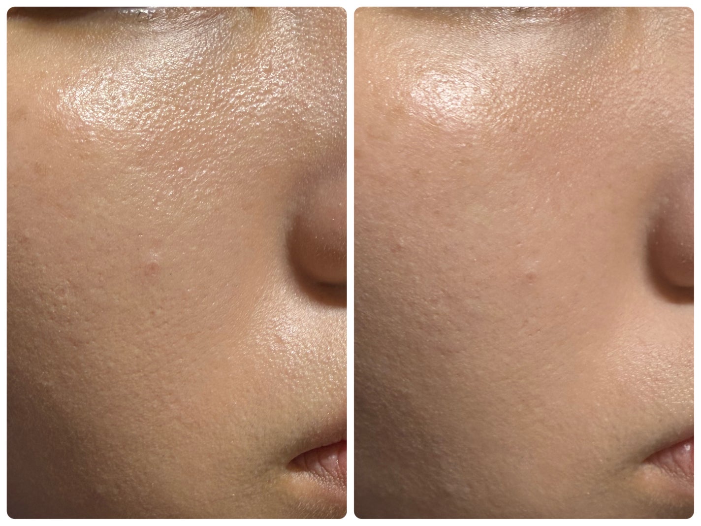 フィニッシングパウダー マット/チャコット・コスメティクス/ルースパウダーを使ったクチコミ(5枚目)