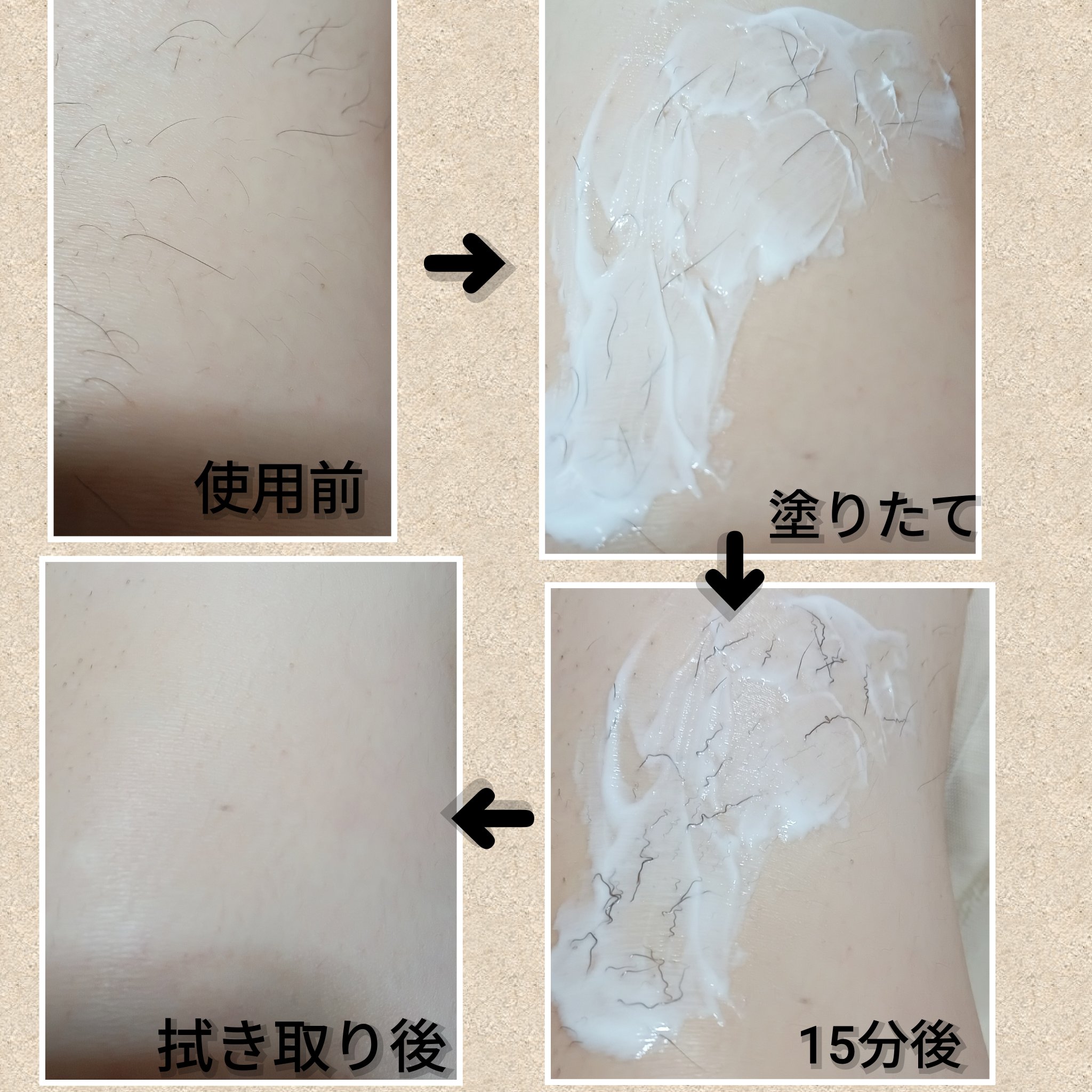 パイナップル豆乳除毛クリーム/鈴木ハーブ研究所/除毛クリームを使ったクチコミ（3枚目）