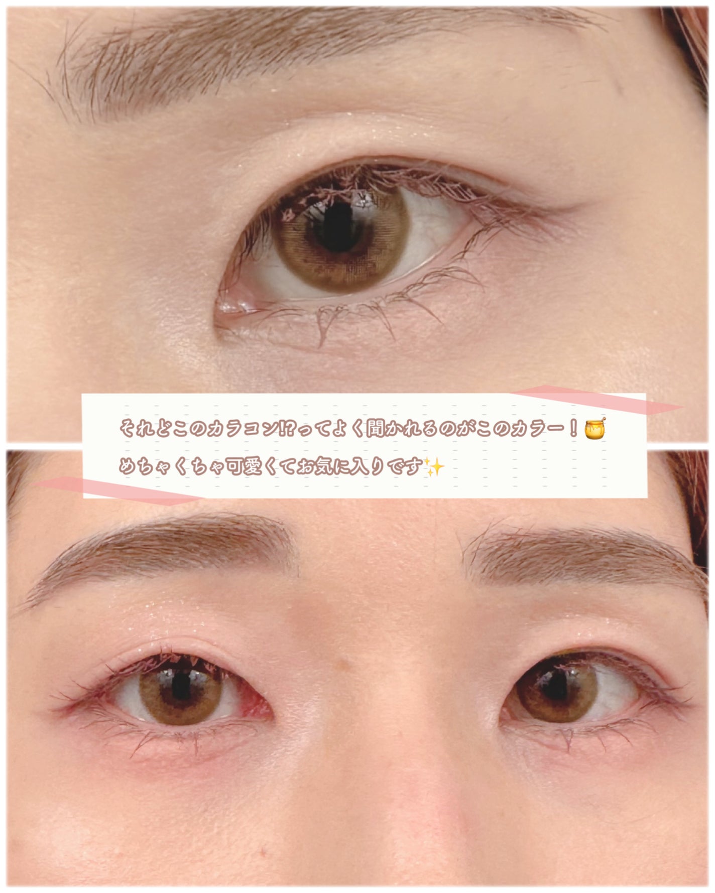 meruru メルル ソフトコンタクトつけはずし器具/meruru/その他を使ったクチコミ(3枚目)