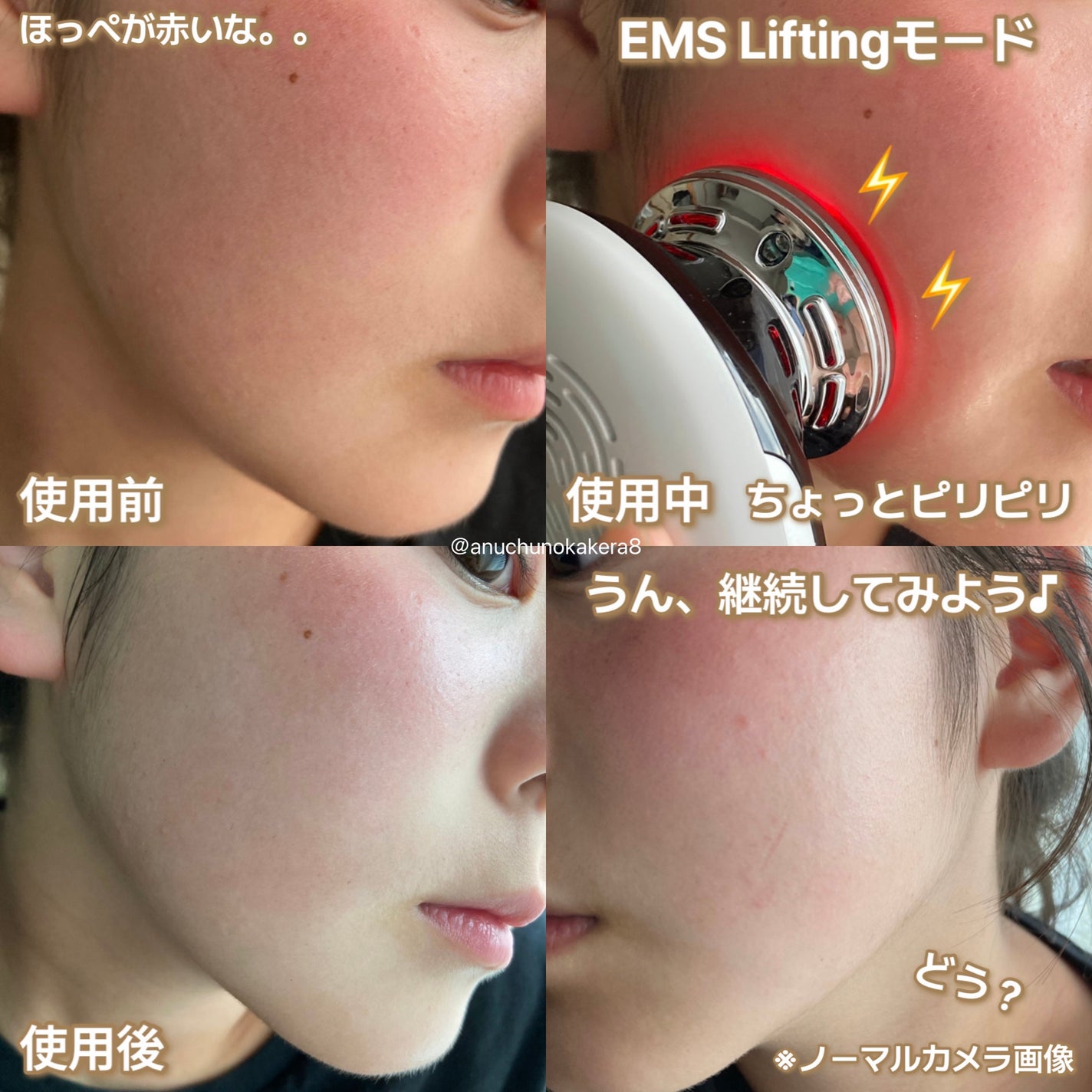 多機能温冷美顔器/ANLAN/美顔器・マッサージを使ったクチコミ(10枚目)