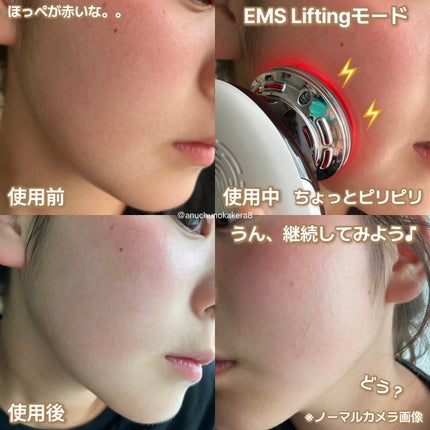 多機能温冷美顔器/ANLAN/美顔器・マッサージを使ったクチコミ(10枚目)