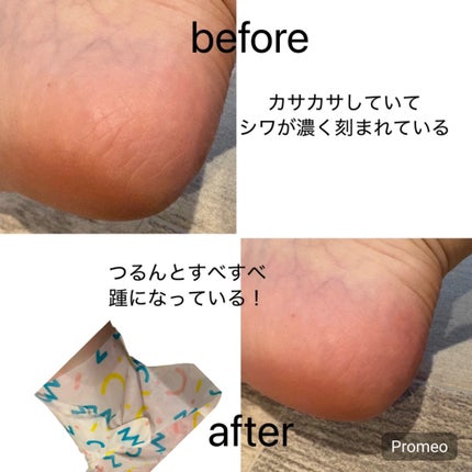 インデップス™モイスチャーバイオセルロースマスク/MADFORCOS/シートマスク・パックを使ったクチコミ(6枚目)