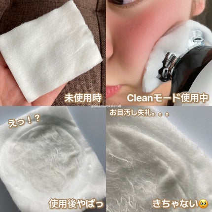 多機能温冷美顔器/ANLAN/美顔器・マッサージを使ったクチコミ(8枚目)