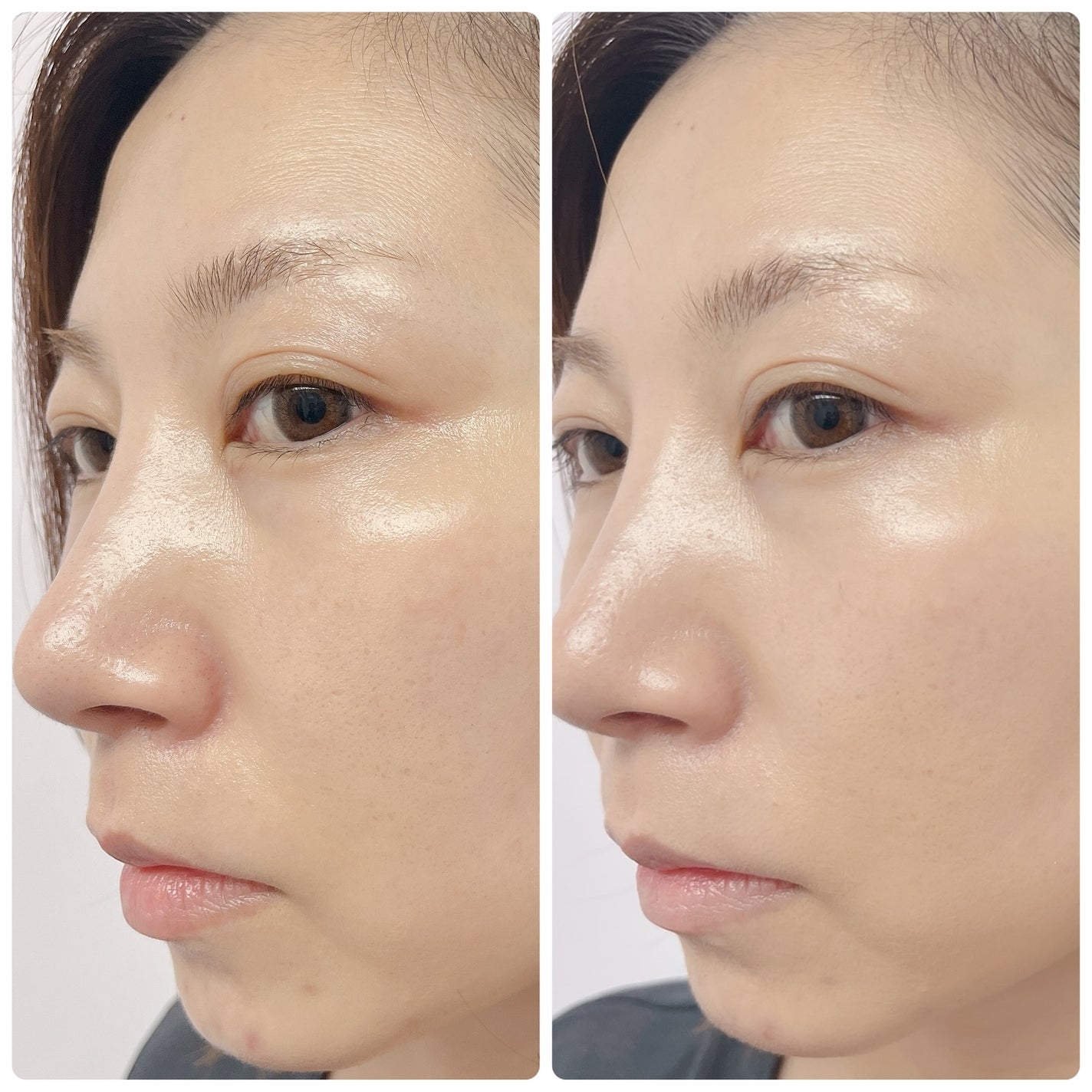 メロウスキンリキッドファンデーション/&nd by rom&nd/リキッドファンデーションを使ったクチコミ(6枚目)