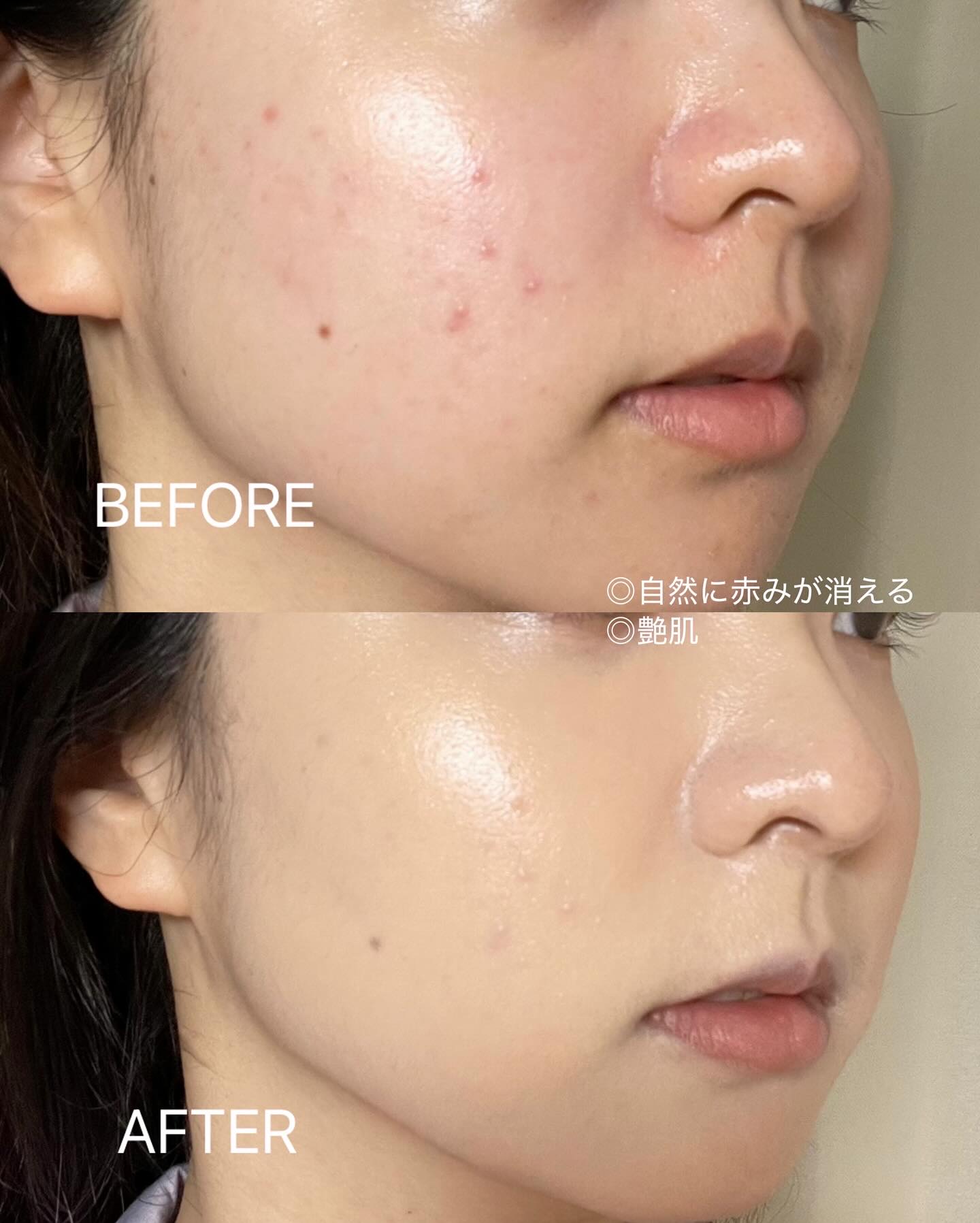 キルカバー メッシュ グロウ エッセンシャル クッション/CLIO/クッションファンデーションを使ったクチコミ（2枚目）