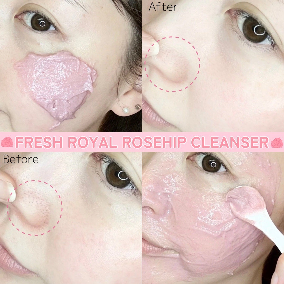 アレンシアフレッシュもちソープ「ロイヤルローズヒップ」/アレンシア/その他洗顔料を使ったクチコミ(2枚目)