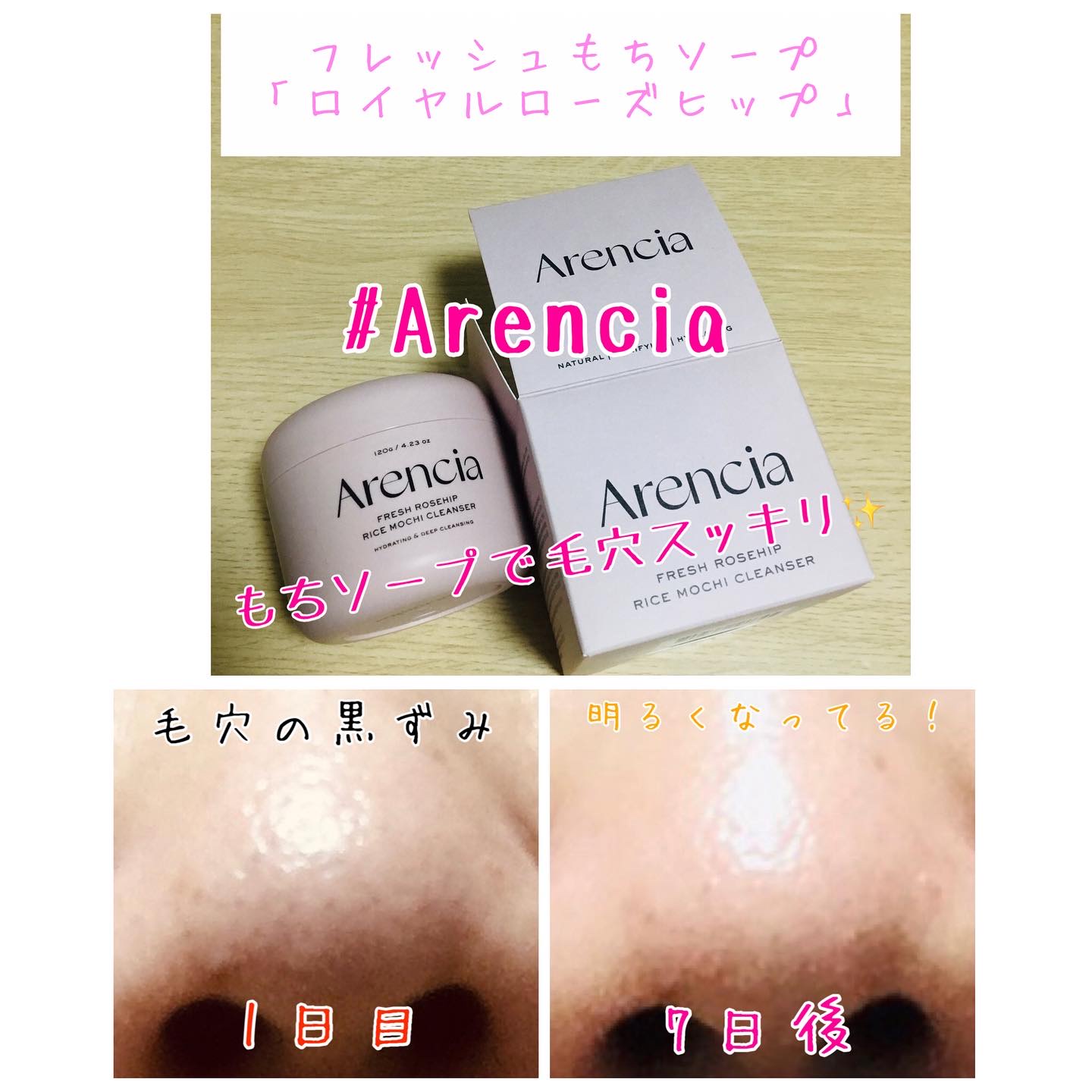 アレンシアフレッシュもちソープ「ロイヤルローズヒップ」/アレンシア/その他洗顔料を使ったクチコミ（1枚目）