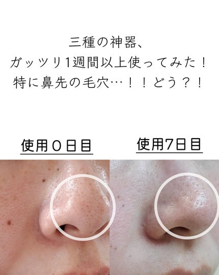 A1カーミング アンプル/VT/美容液を使ったクチコミ(9枚目)