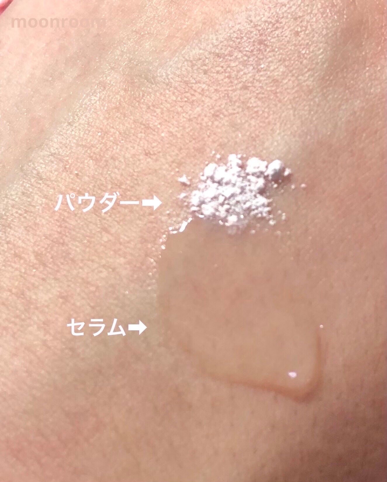 ジンクテカBセラム/BRING GREEN/美容液を使ったクチコミ(2枚目)