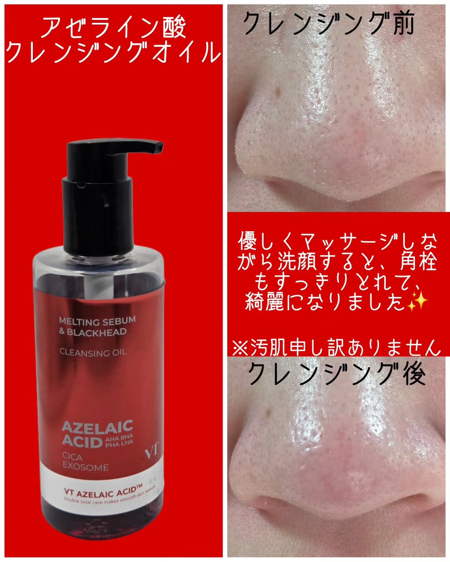 AZケア トナーパッド/VT/トナーパッドを使ったクチコミ（3枚目）