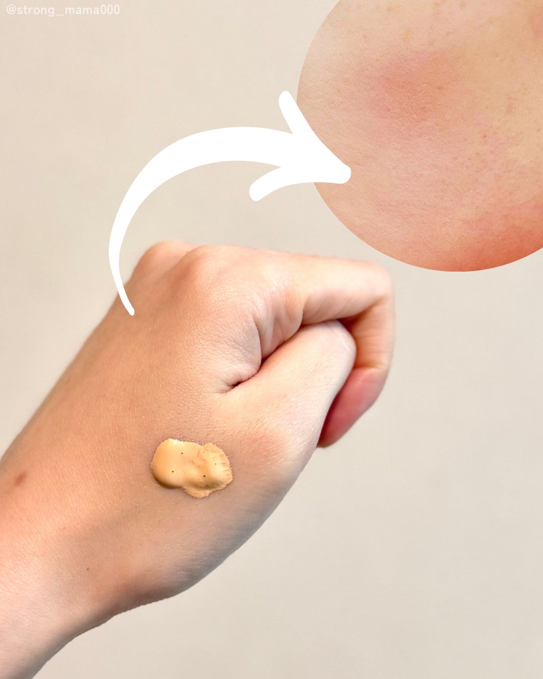 ã¢ã³ãªãããã ã±ã¢ ã〠ã»ã©ã ãã¡ã³ããŒã·ã§ã³/shu uemura/ãªããããã¡ã³ããŒã·ã§ã³ã䜿ã£ãã¯ãã³ãïŒ4æç®ïŒ