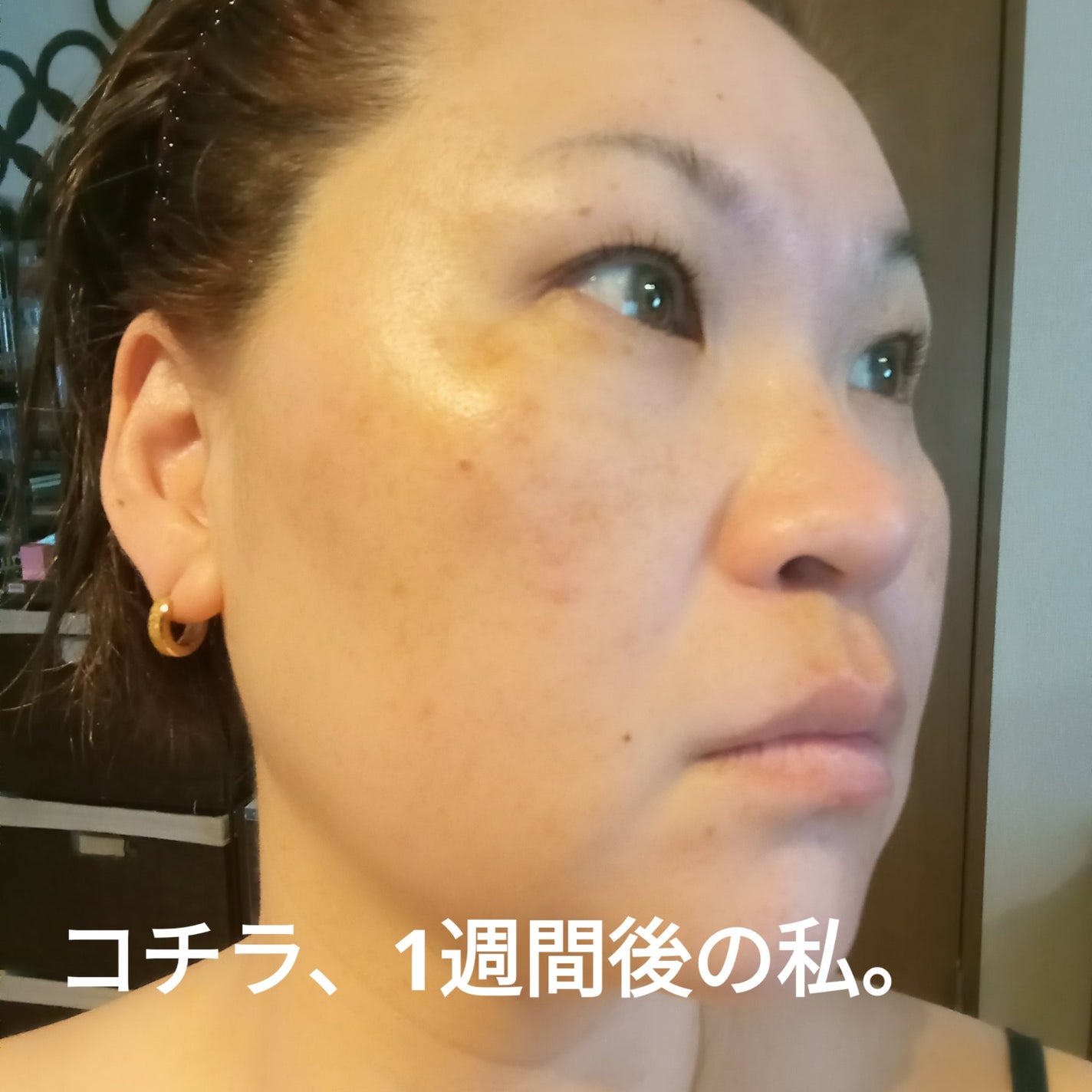 PDRNカフェインショット/IOPE/美容液を使ったクチコミ(5枚目)