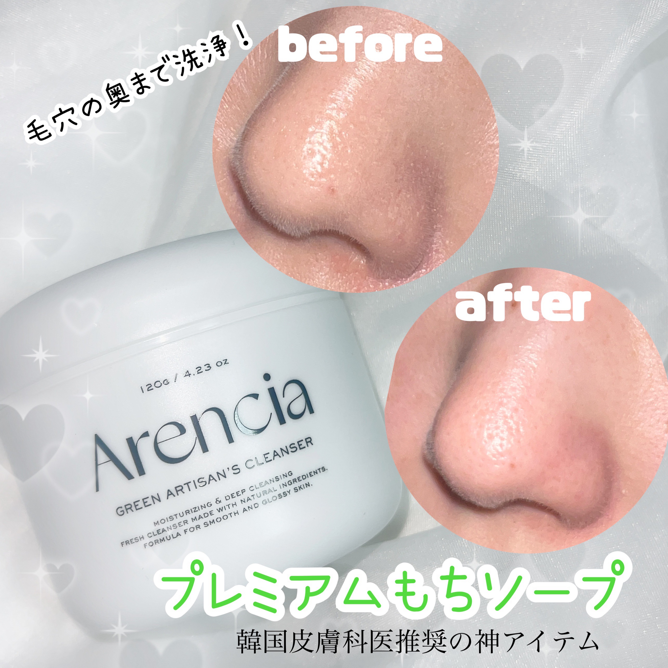 プレミアムもちソープ「グリーンアルティザン」/アレンシア/その他洗顔料を使ったクチコミ（1枚目）