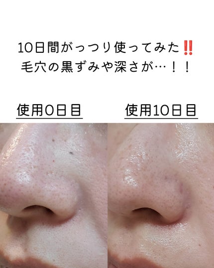 AZケア クレンジングオイル/VT/オイルクレンジングを使ったクチコミ(5枚目)