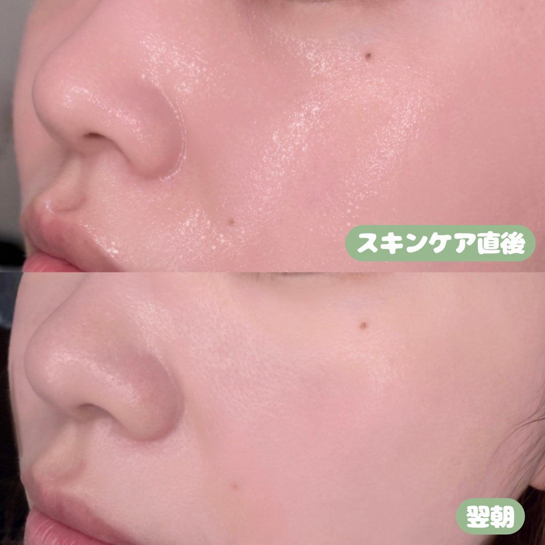 青麦ジンクセラム/Veganifect/美容液を使ったクチコミ(2枚目)