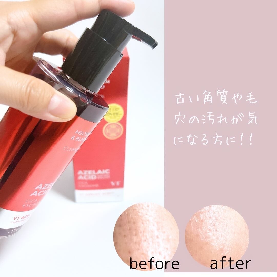 AZケア クレンジングオイル/VT/オイルクレンジングを使ったクチコミ(3枚目)