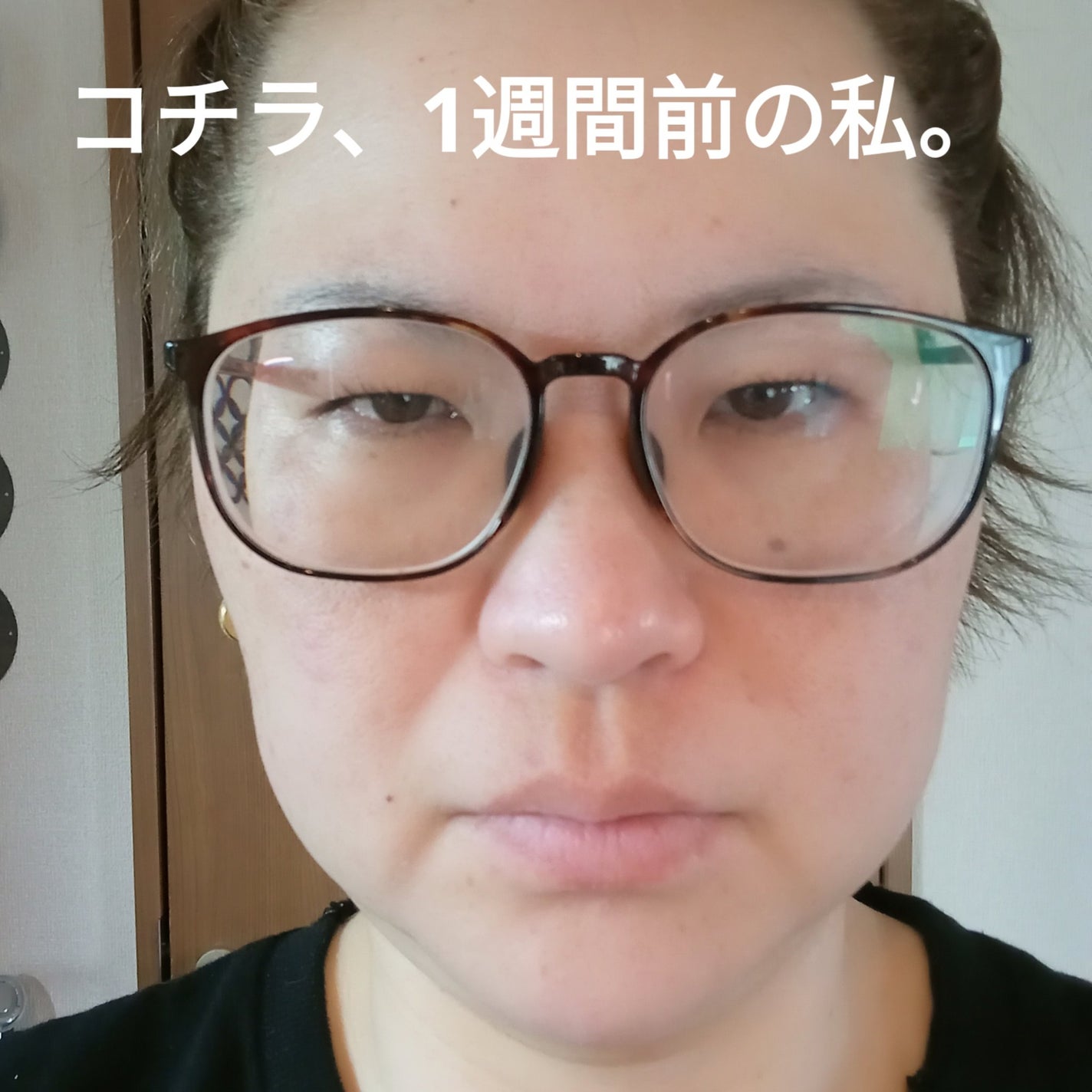 PDRNカフェインショット/IOPE/美容液を使ったクチコミ(2枚目)