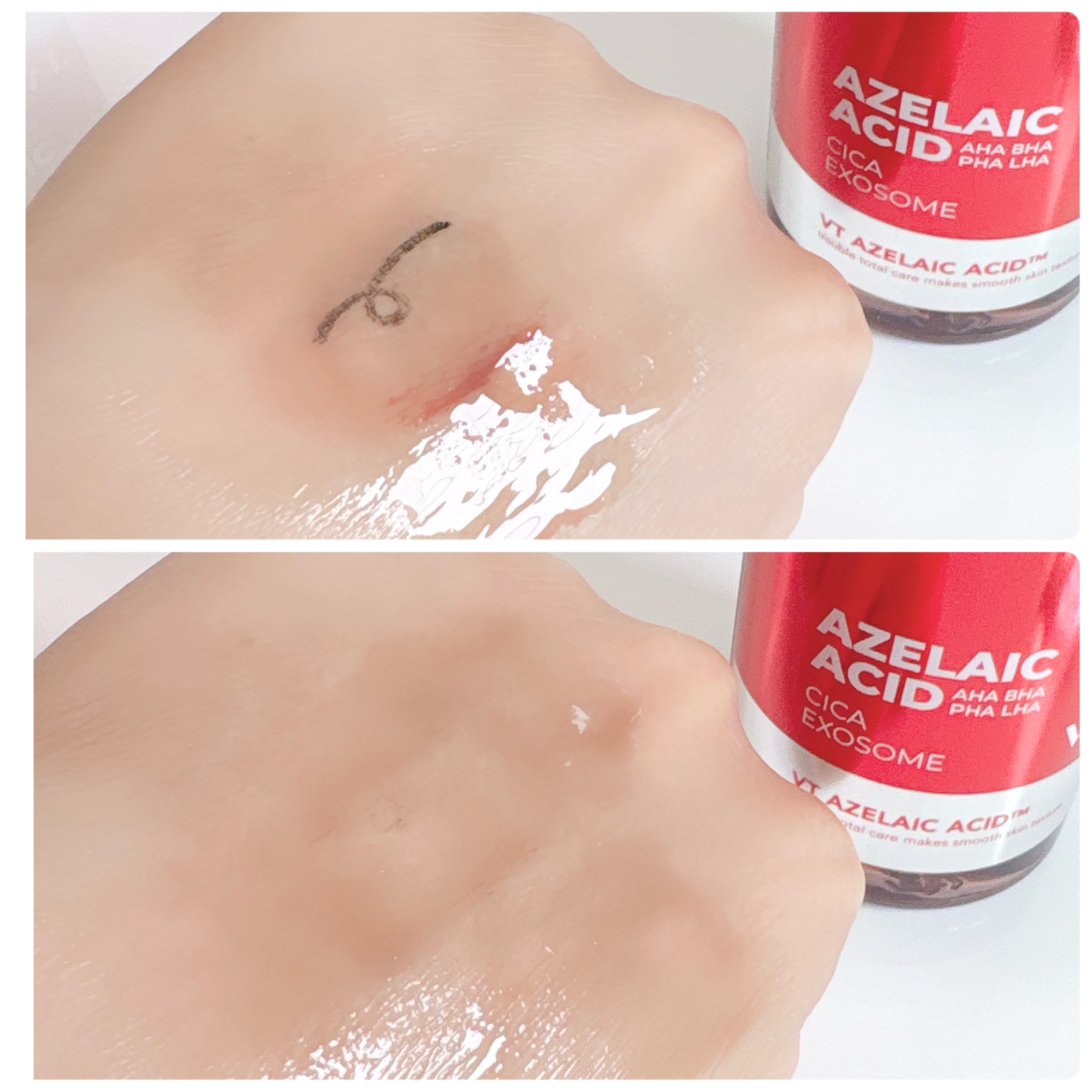 A1カーミング アンプル/VT/美容液を使ったクチコミ（3枚目）