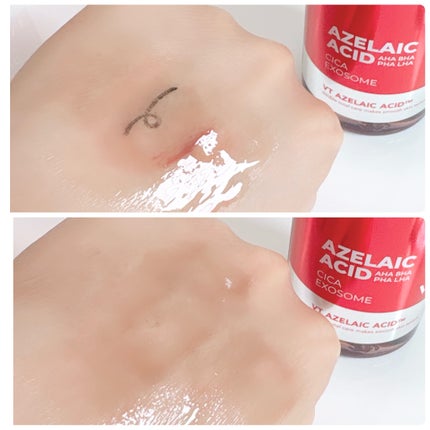 A1カーミング アンプル/VT/美容液を使ったクチコミ(3枚目)