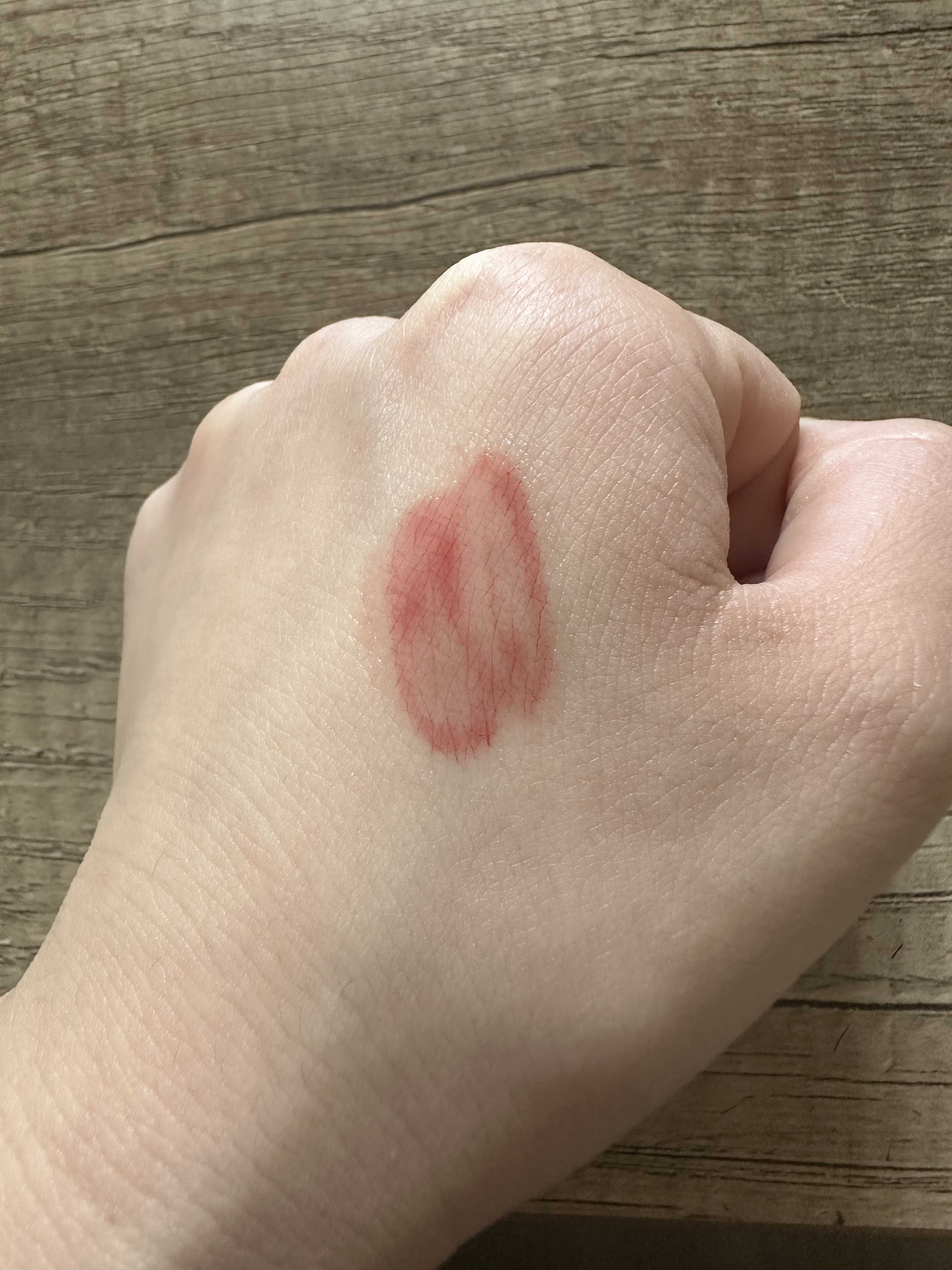 アイロンティントリップ/JUDYDOLL/リップティントを使ったクチコミ（3枚目）