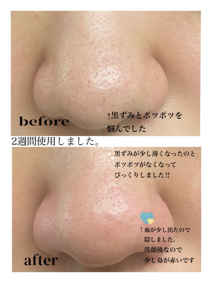 A1カーミング アンプル/VT/美容液を使ったクチコミ(5枚目)