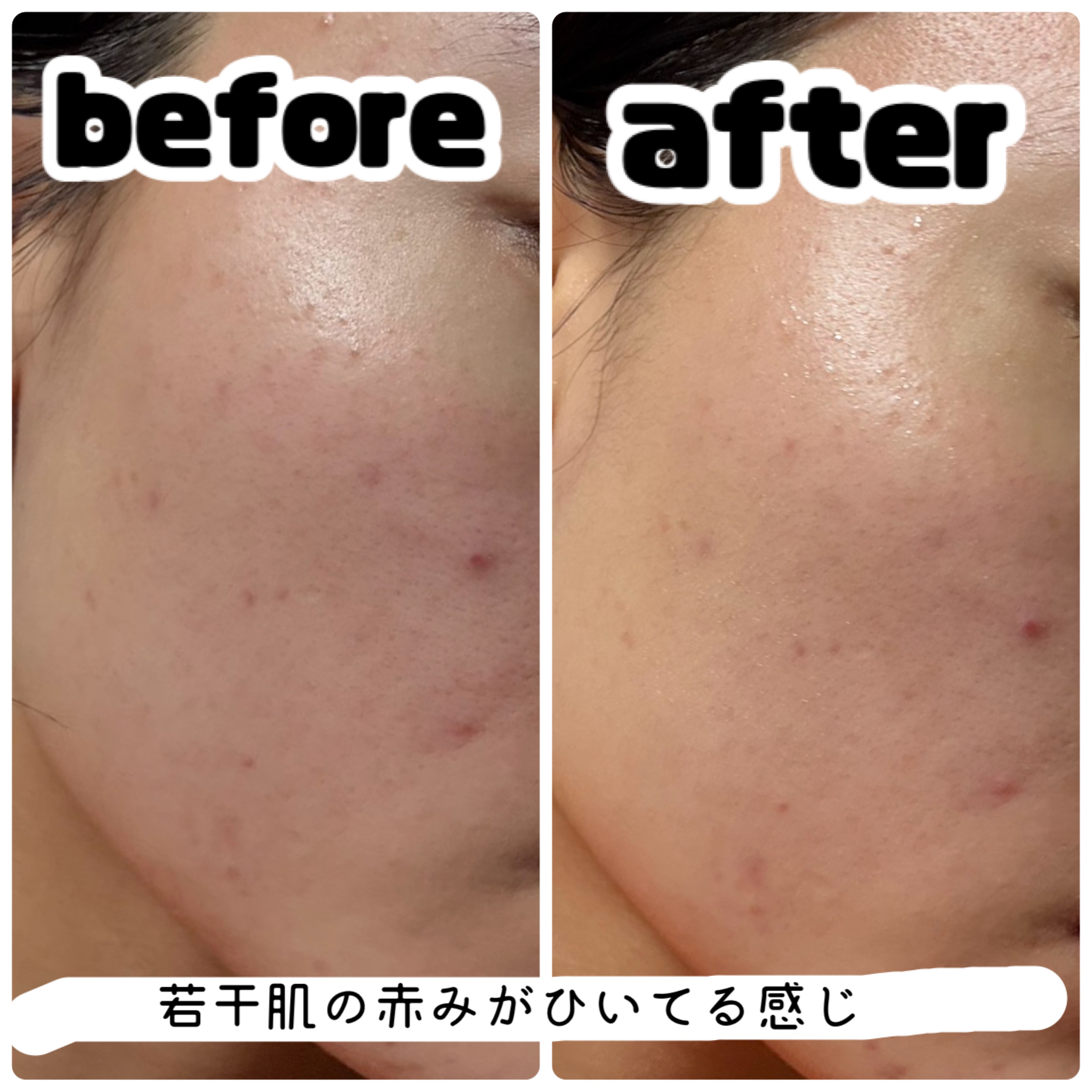 ロージー マスク/ラッシュ/洗い流すパック・マスクを使ったクチコミ（2枚目）