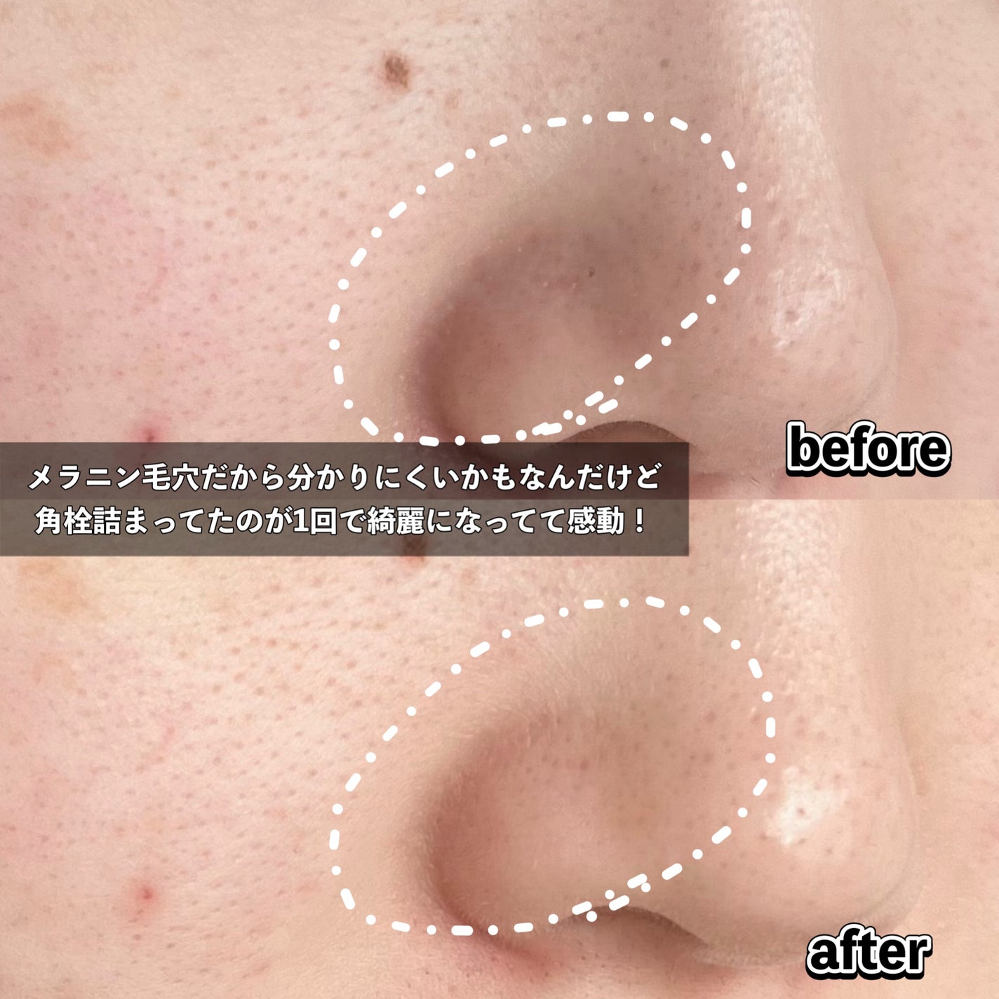 プレミアムもちソープ「グリーンアルティザン」/アレンシア/その他洗顔料を使ったクチコミ(6枚目)