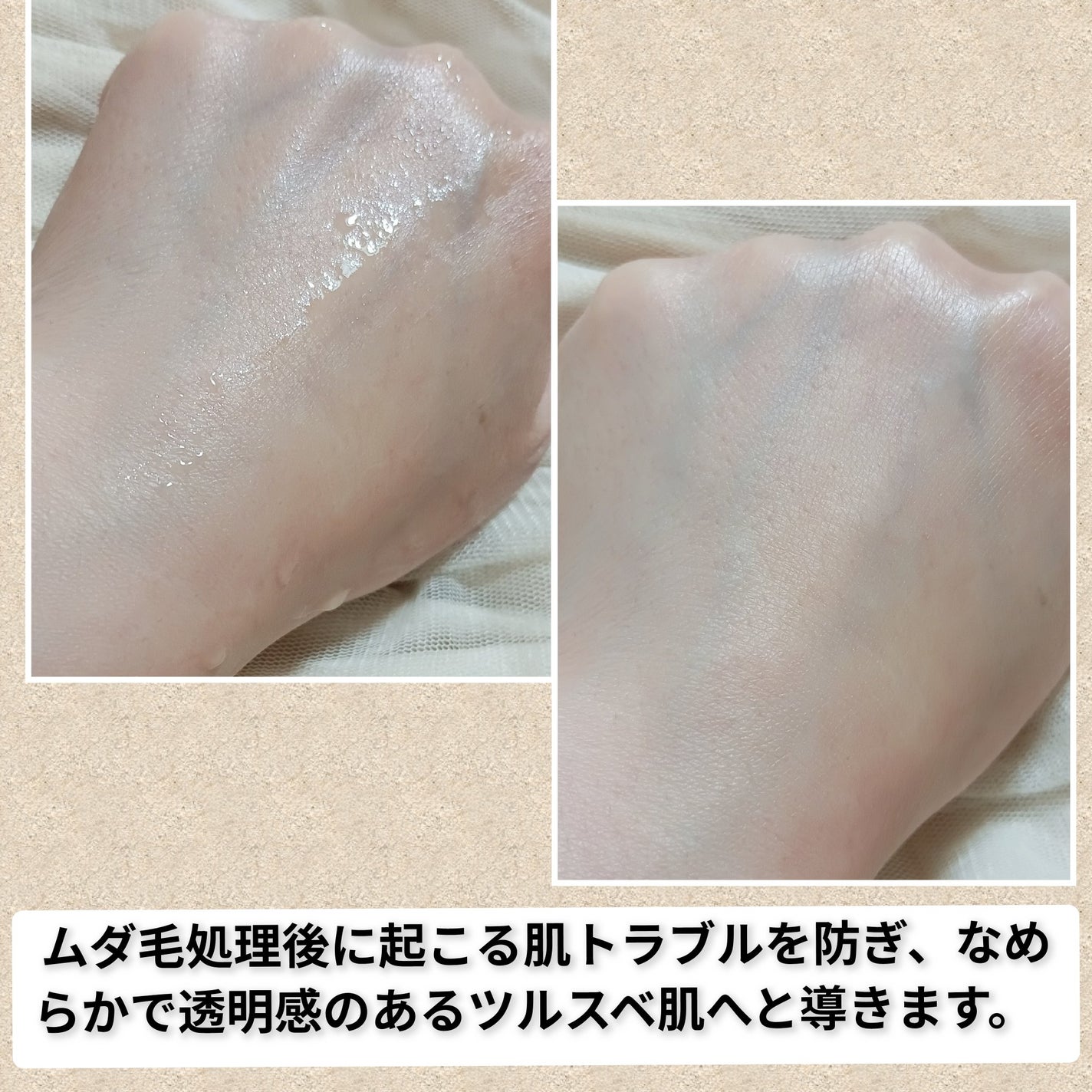 パイナップル豆乳ローションプレミアム/鈴木ハーブ研究所/ボディローションを使ったクチコミ(3枚目)