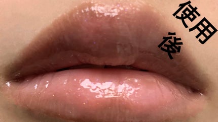 ニードルプランパー 電撃チェリー/Ui2./リッププランパーを使ったクチコミ(9枚目)