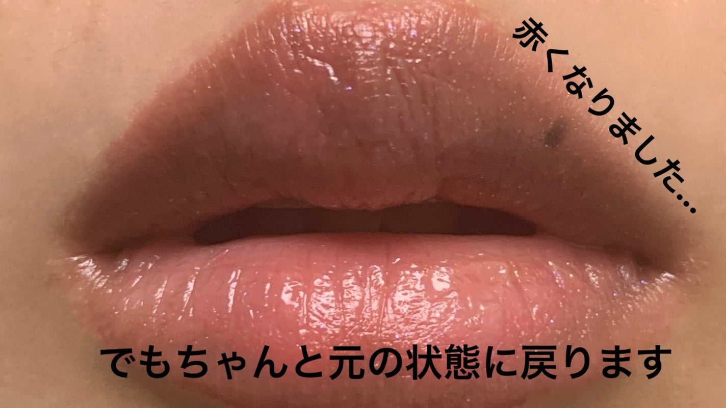 ニードルプランパー 電撃チェリー/Ui2./リッププランパーを使ったクチコミ(10枚目)