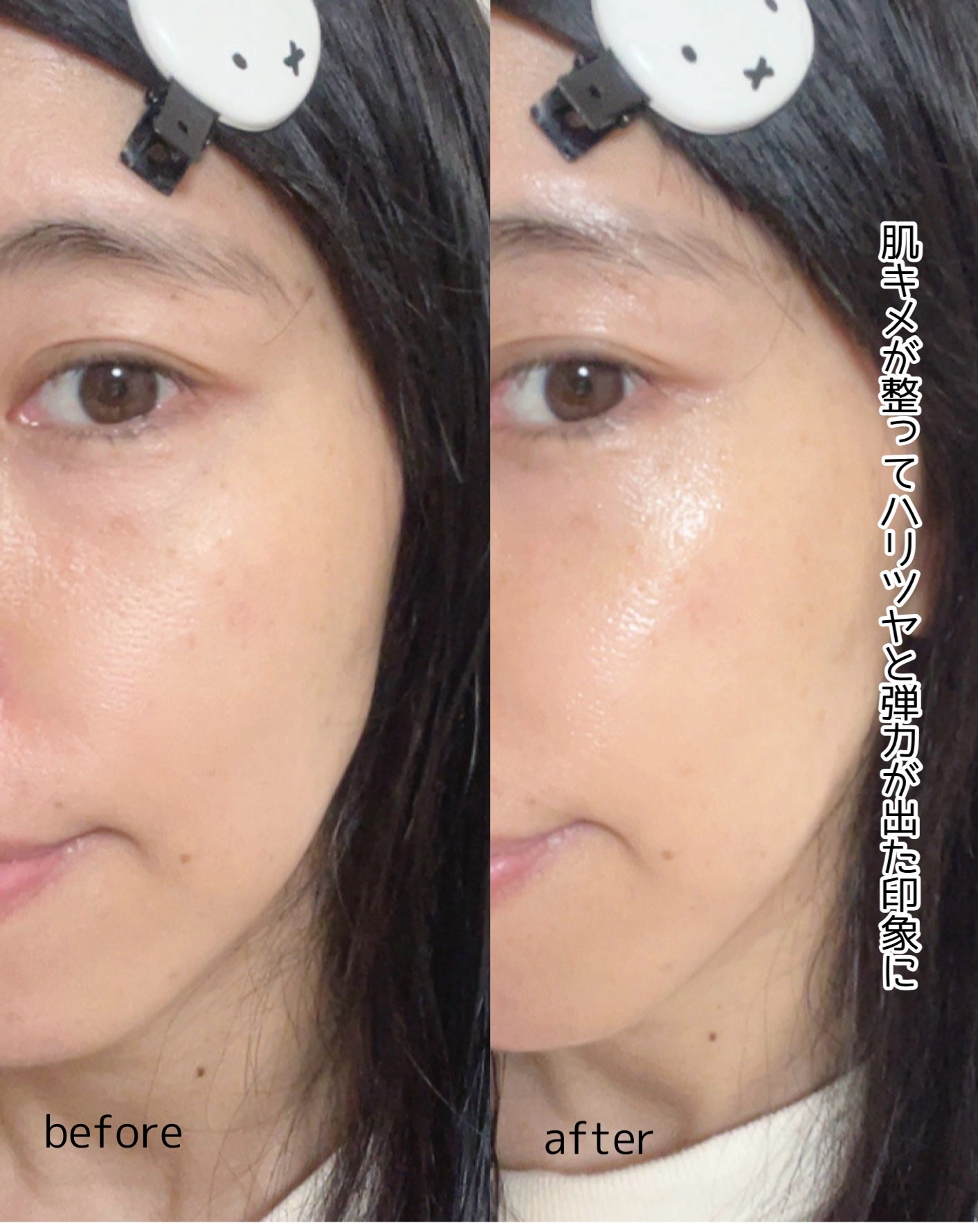 プロバイオダーム™ コラーゲン リモデリング ブースターショット プログラム/BIOHEAL BOH/美容液を使ったクチコミ(5枚目)