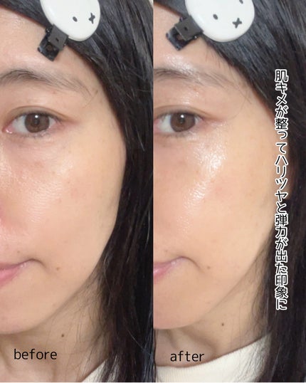 プロバイオダーム™ コラーゲン リモデリング ブースターショット プログラム/BIOHEAL BOH/美容液を使ったクチコミ(5枚目)