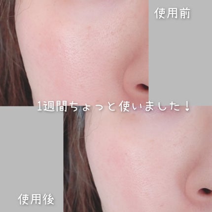 A1カーミング アンプル/VT/美容液を使ったクチコミ(9枚目)
