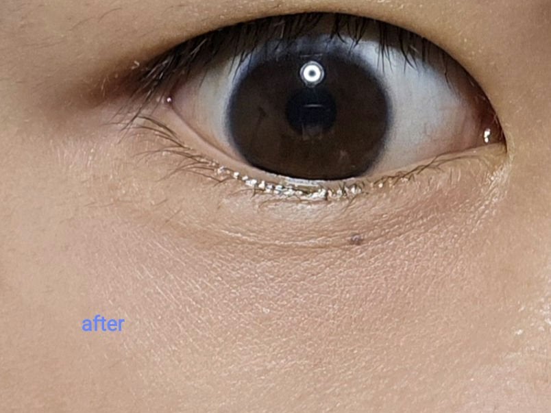 カラーミキシングコンシーラー/キャンメイク/パレットコンシーラーを使ったクチコミ(4枚目)