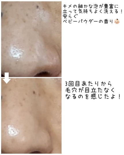 BnD マシュマロ コラーゲン AHA スクラブ /BnD/ボディスクラブを使ったクチコミ(6枚目)