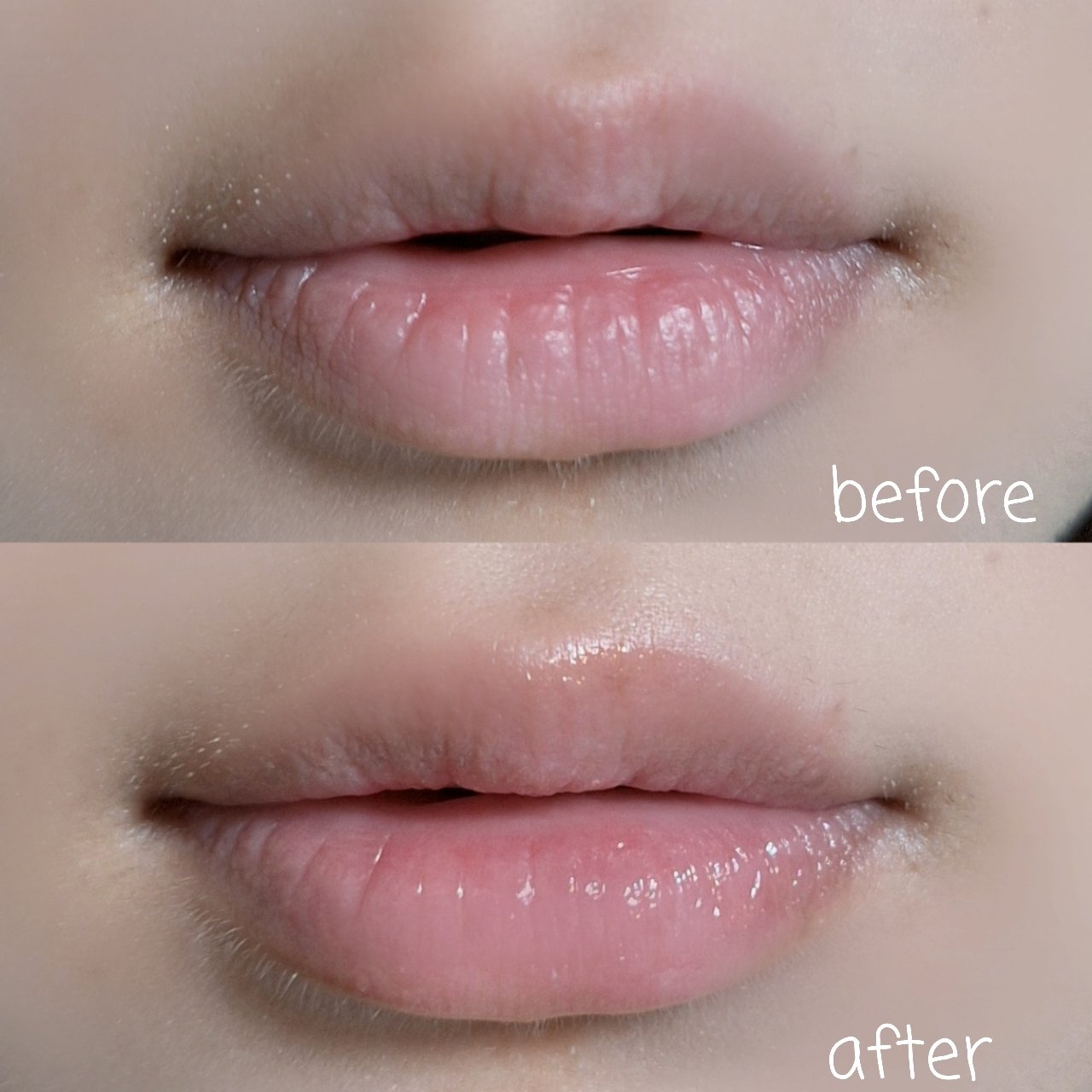 リップガーディアン　プランプスティック/LIPGUARDIAN/リッププランパーを使ったクチコミ（3枚目）