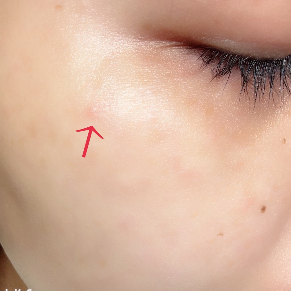 リードルS PDRN+ セラム/VT/美容液を使ったクチコミ（3枚目）