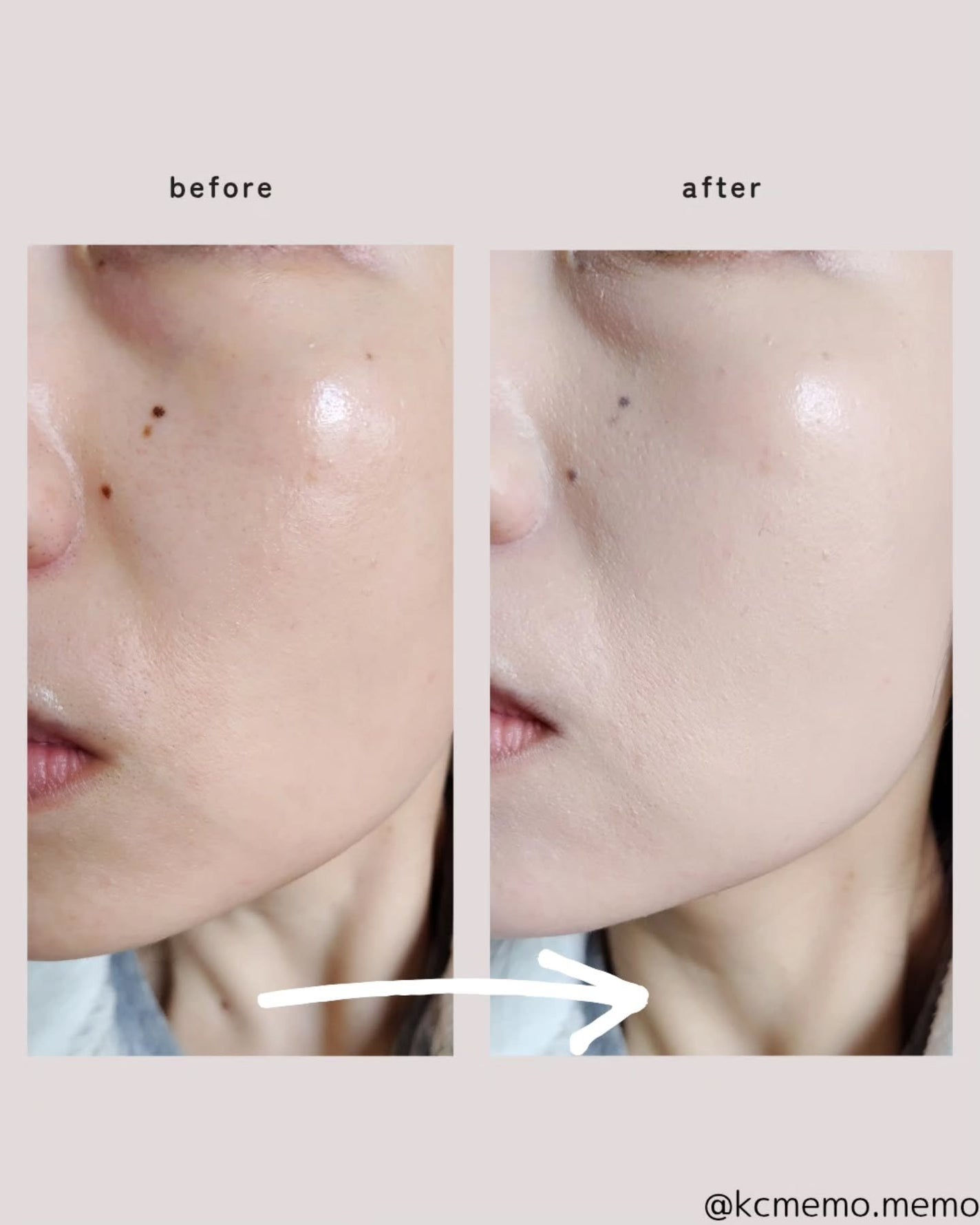 スキンレイヤーフィットクッション/ABOUT TONE/クッションファンデーションを使ったクチコミ(7枚目)