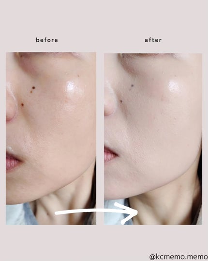 スキンレイヤーフィットクッション/ABOUT TONE/クッションファンデーションを使ったクチコミ(7枚目)