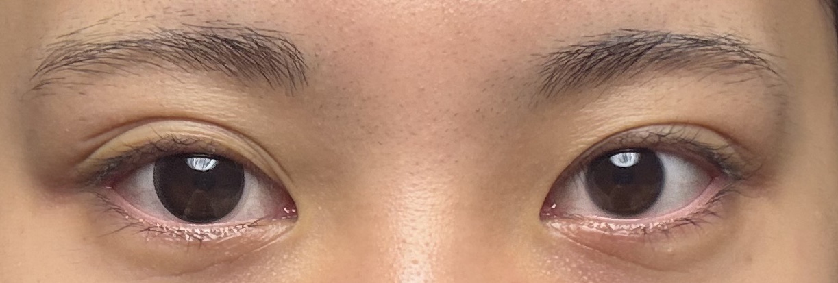 ネオサイトワンデー リングUV ブラック/Aire/ワンデー（１DAY）カラコンを使ったクチコミ（2枚目）