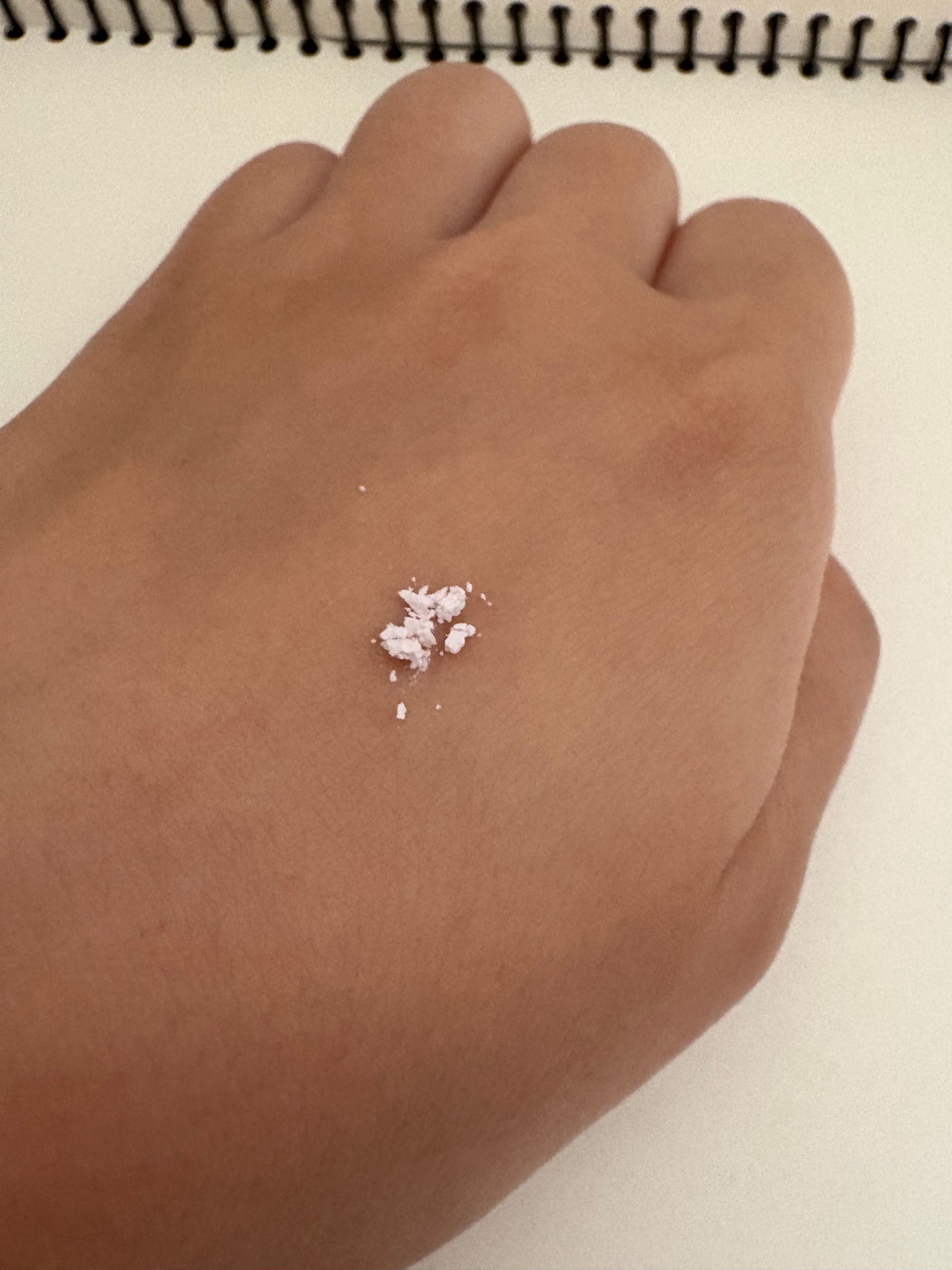 ジンクテカBセラムセット/BRING GREEN/スキンケアキットを使ったクチコミ(9枚目)