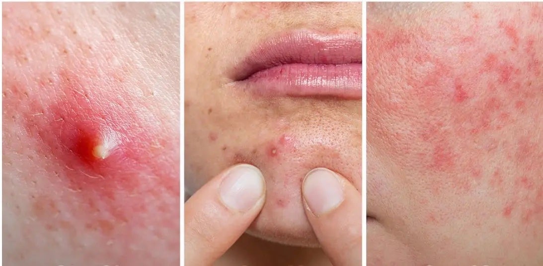 アゼライン酸16BBスージングセラム/MEDICUBE/美容液を使ったクチコミ(4枚目)