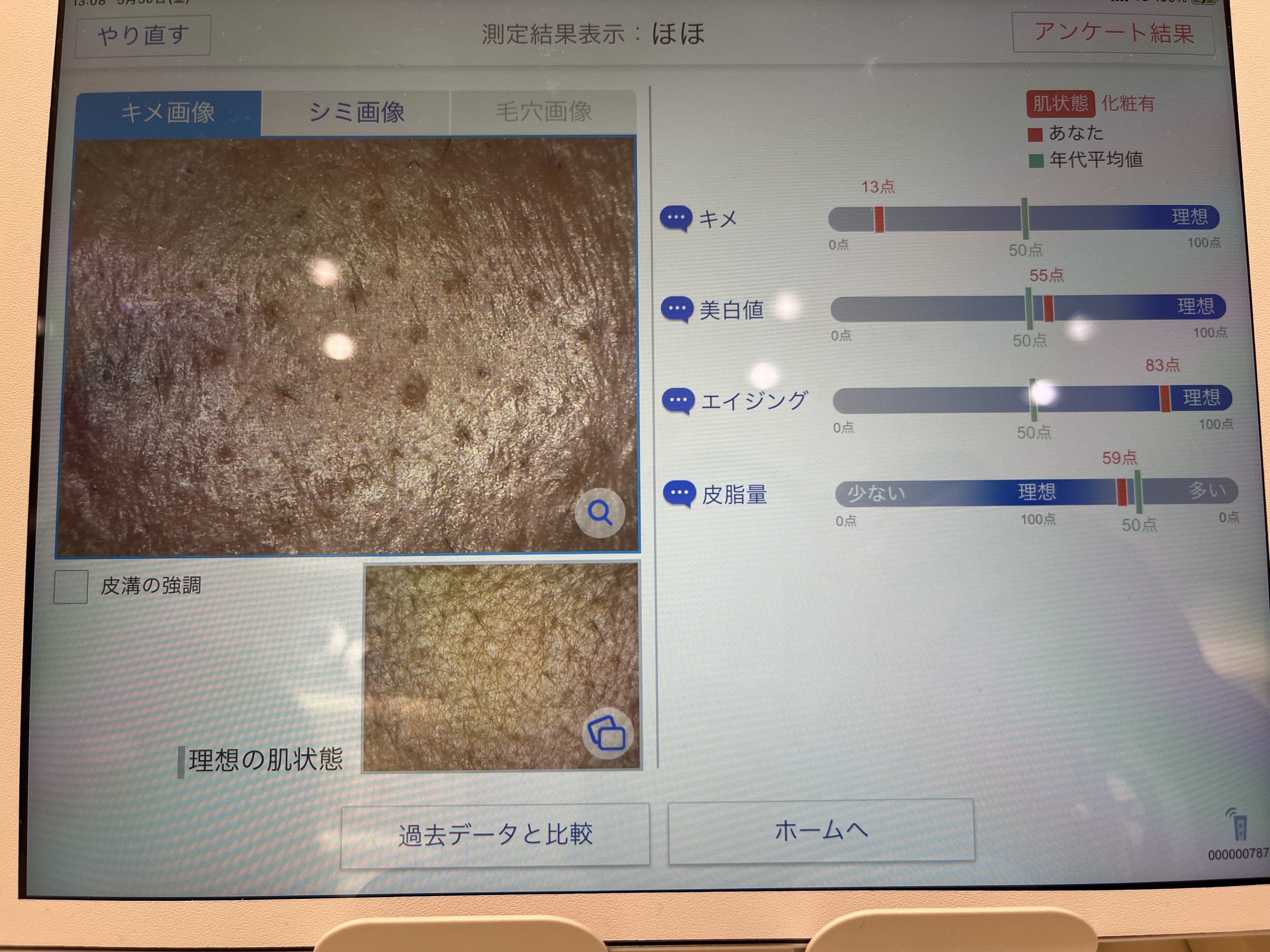 を使ったクチコミ（1枚目）